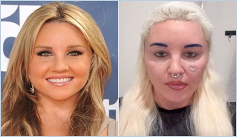 Shannon Elizabeth Plastic Surgery Before and After